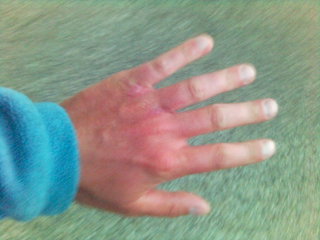 Hand