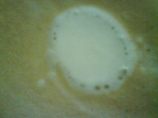 Milchblupps.