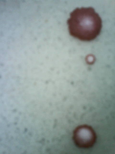 Flecken